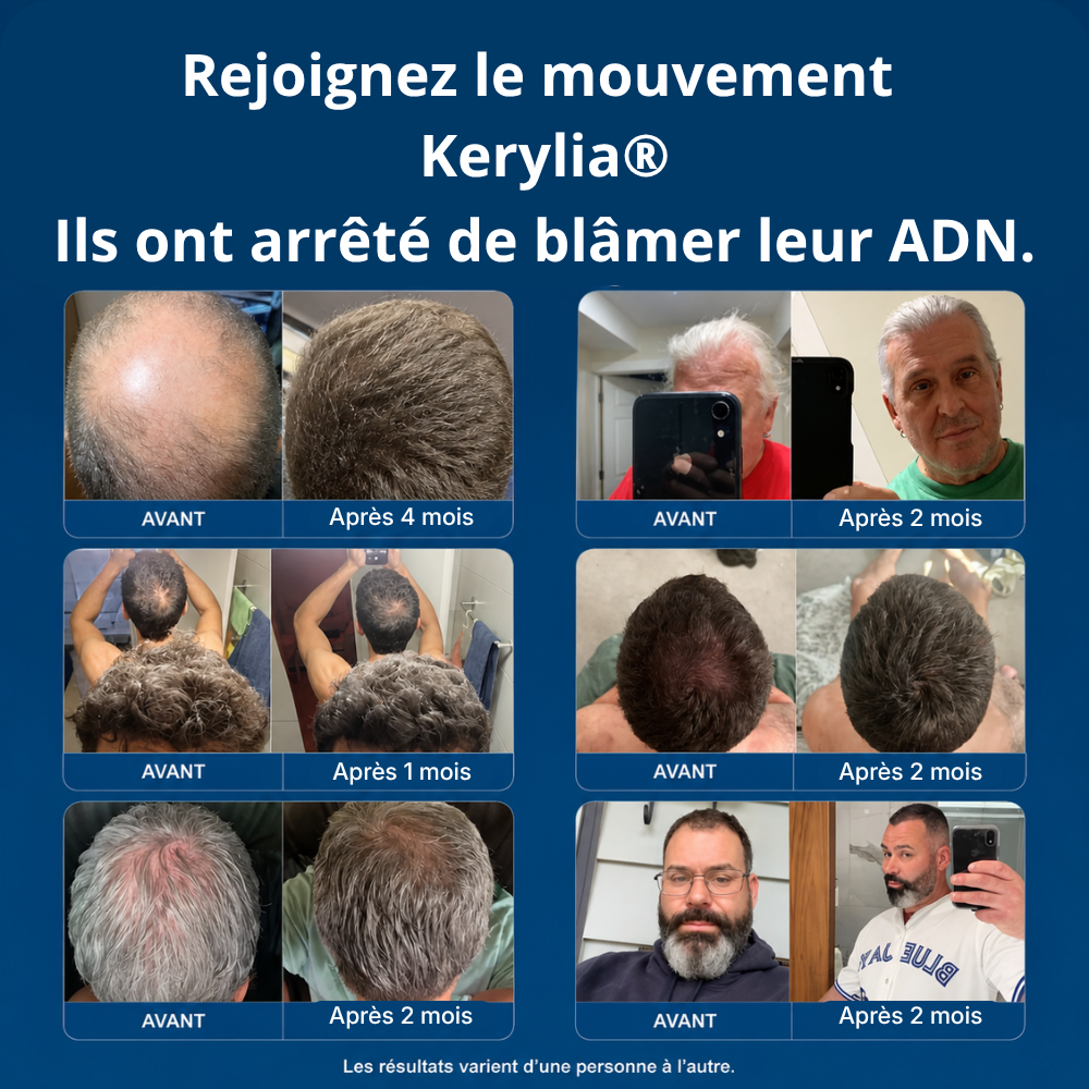 Micro-Infuse® - Atteint la racine, relance la repousse