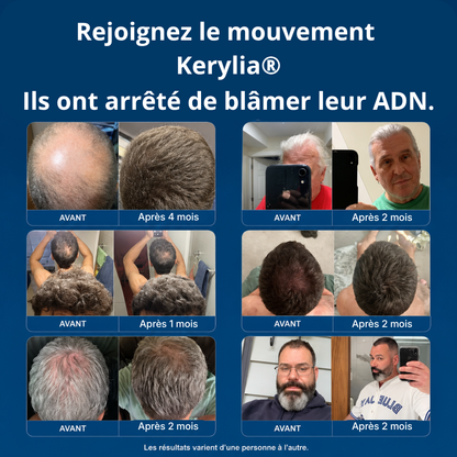 Micro-Infuse® - Atteint la racine, relance la repousse
