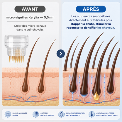Micro-Infuse® - Atteint la racine, relance la repousse