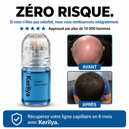 Micro-Infuse® - Atteint la racine, relance la repousse